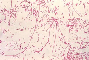 legionella